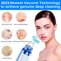 Blackhead Remover Pore Vacuum Pore Cleaner Comedone Whitehead Extractor Tool-5 Suction Power,5 Probes,USB Rechargeable Blackhead Vacuum Kit