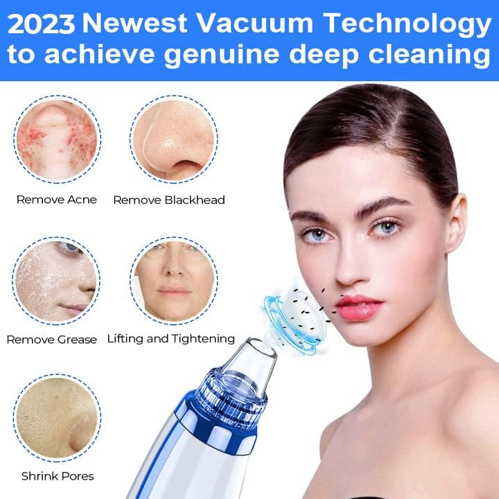 Blackhead Remover Pore Vacuum Pore Cleaner Comedone Whitehead Extractor Tool-5 Suction Power,5 Probes,USB Rechargeable Blackhead Vacuum Kit