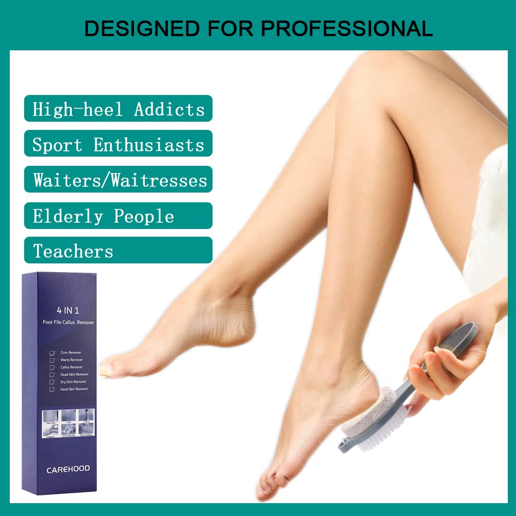 CAREHOOD Foot File Callus Remover - Multi Purpose 4 in 1 Feet Pedicure Tools with Foot Scrubber, Pumice Stone, Foot Rasp and Sand Paper for Home Foot Care (Grey Pedicure Foot File)