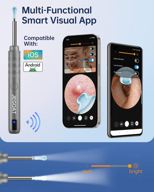 Ear Wax Removal Tool Camera, Ear Cleaner with Camera, Ear Cleaning Kit 1296P HD Ear Scope, 6 LED Lights and 12 Ear Picks, Earwax Removal with Otoscope to Earify Earwax for iOS and Android