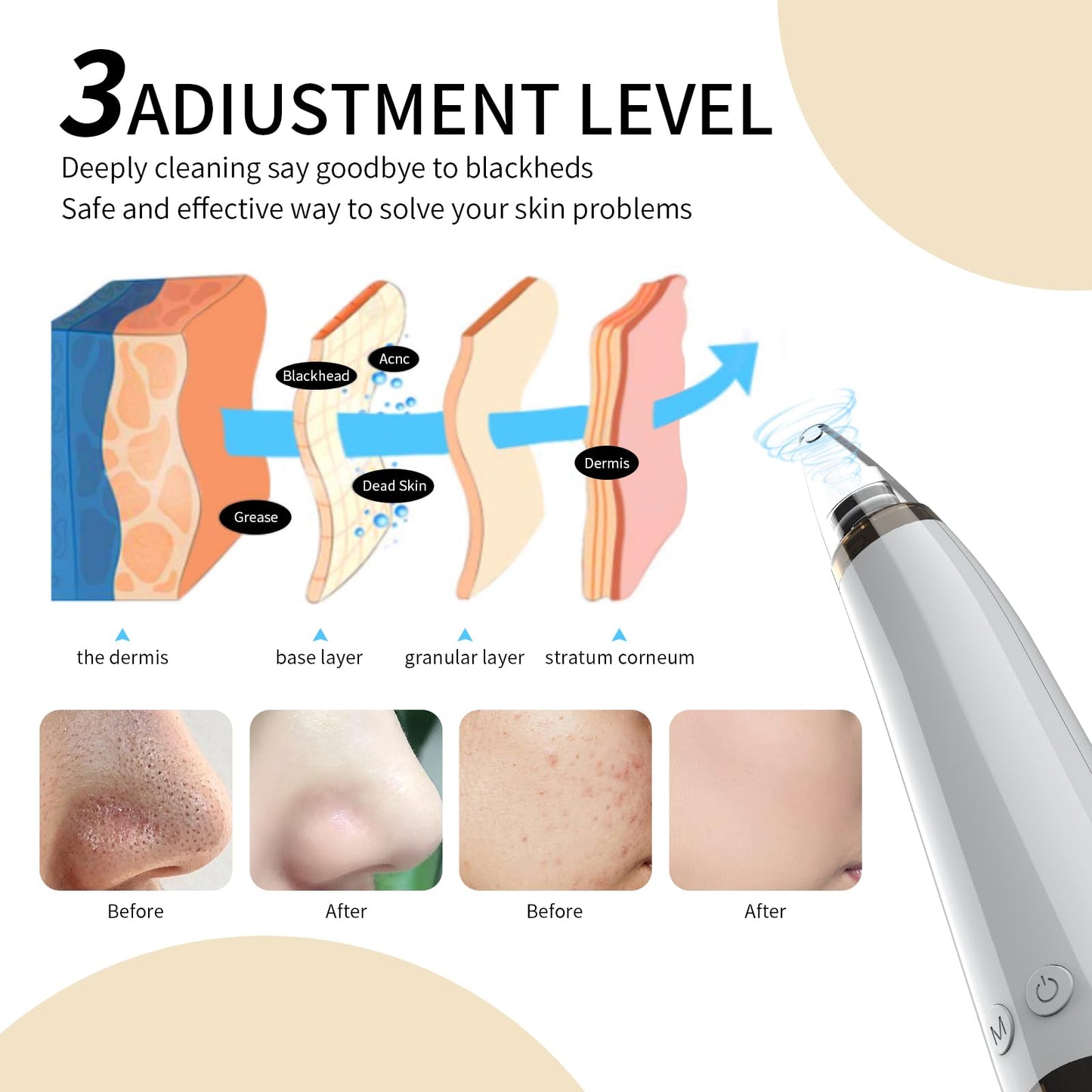 Blackhead Remover Pore Vacuum Cleaner - 6 Probes 3 Adjustable Suction Power,USB Rechargeable Blackhead Vacuum Kit Electric Acne Extractor Tool for Adult (Off White)