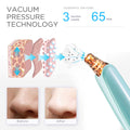 Blackhead Remover Pore Vacuum Cleaner - Upgraded Facial Pore Cleaner - Electric USB Pore Vacuum with 5 Probes - Upgraded Blackhead Suction Tool - Blackhead Remover Kit (Turquoise)