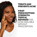 La Roche-Posay Effaclar Adapalene Gel 0.1% Acne Treatment | Retinoid Acne Cream | Acne Medication | Acne Gel For Blackheads & Whiteheads | Oil Free | Helps Clear And Prevent Acne & Clogged Pores