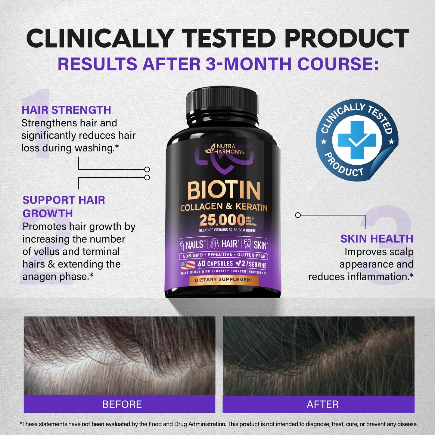 Biotin | Collagen | Keratin - Clinically Tested Supplement - Hair Growth Support - Skin & Nails Complex 25000 mcg - Hyaluronic Acid | B2 | B3 | B6 | B7 - Made in USA - For Women & Men | 60 Capsules